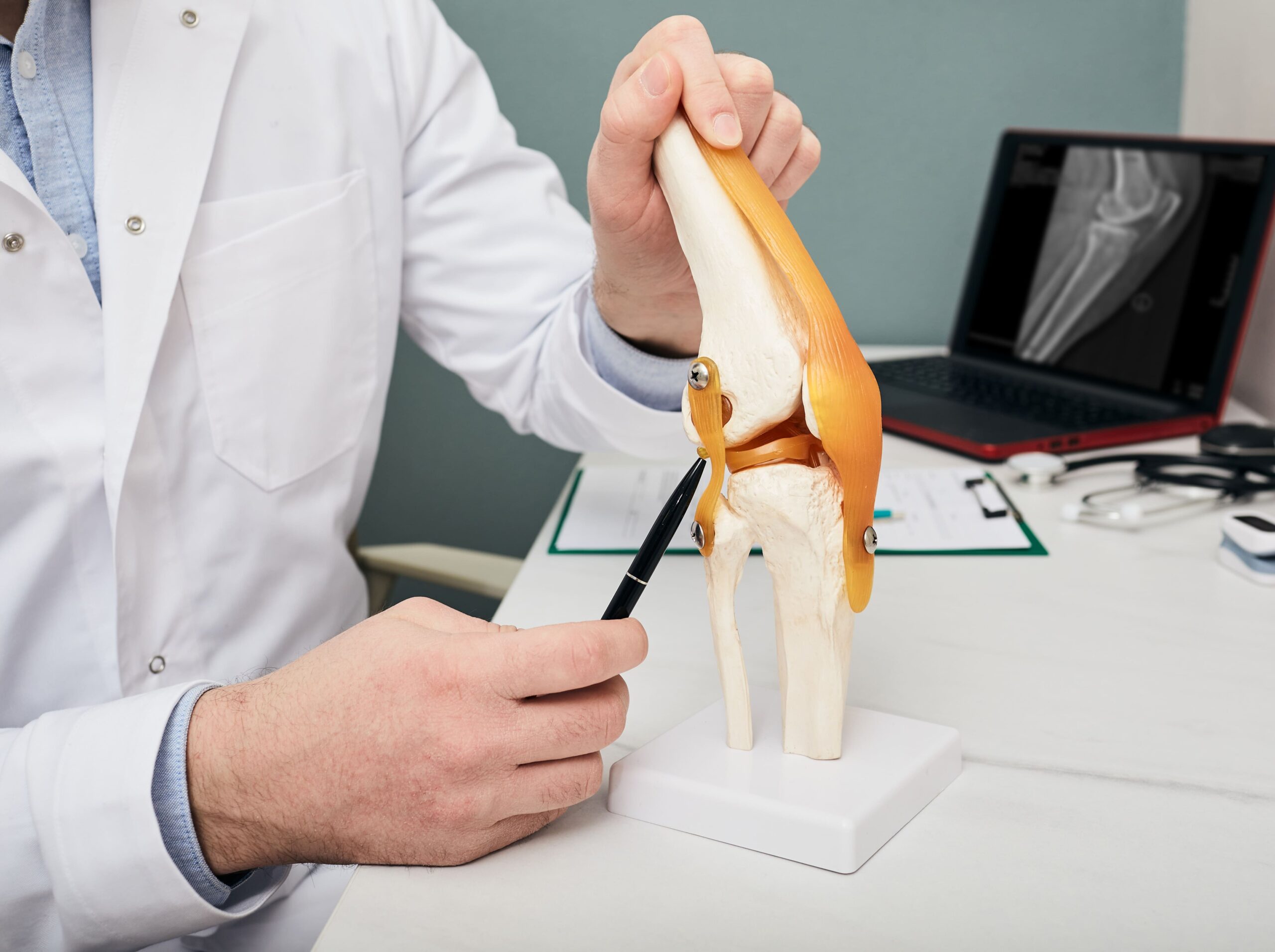 A medical professional in a white coat demonstrates a knee joint model using a pen, with an x-ray image visible on a laptop in the background.