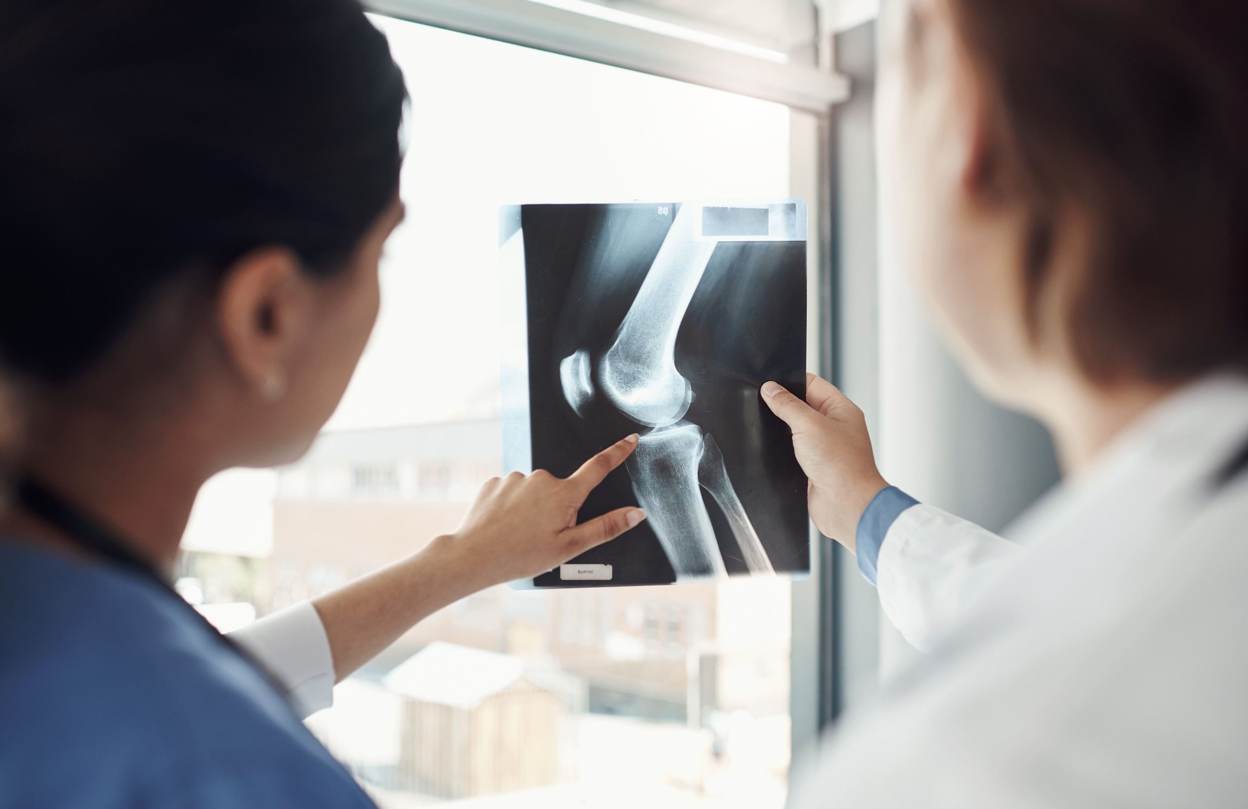 Image medical professionals reviewing knee x ray in offi 2026 03 25 08 56 11 utc (1)